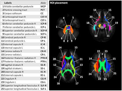 Assessment of Cerebral and Cerebellar White Matter Microstructure in Spinocerebellar Ataxias 1, 2, 3, and 6 Using Diffusion MRI